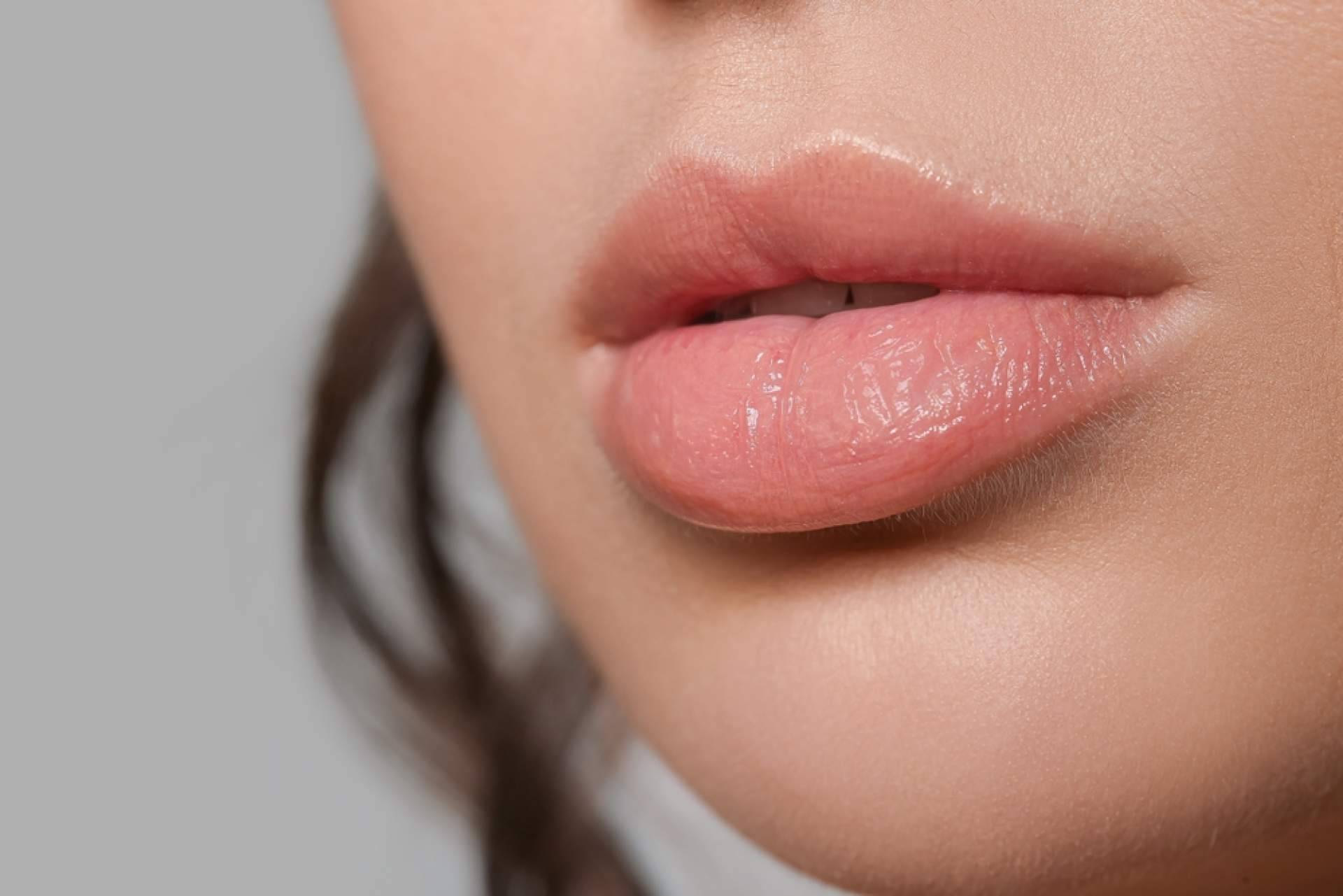 Labios con volumen natural gracias al relleno con ácido hialurónico de Centro Estetica el Pilar