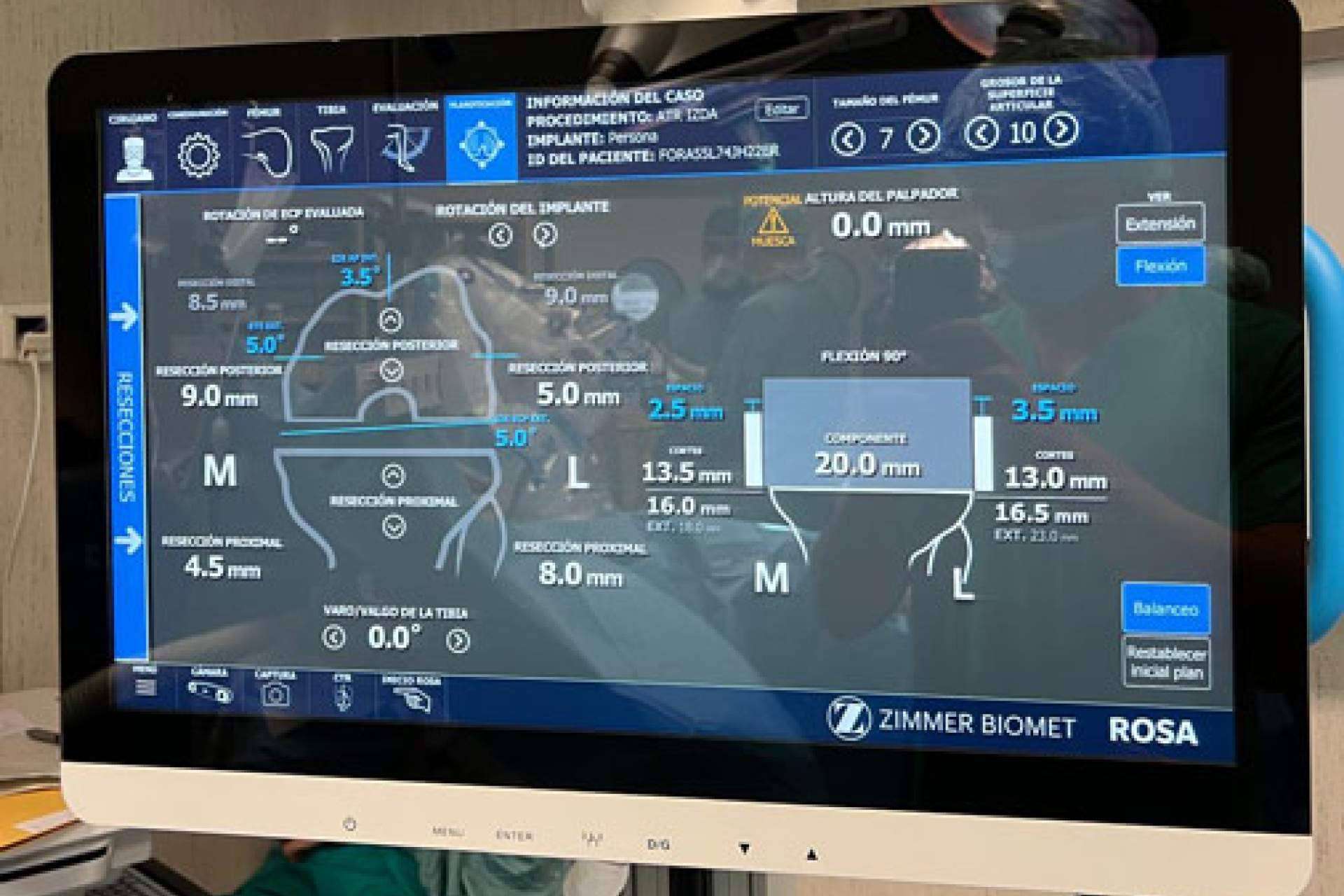 Innovación y Precisión en la Cirugía de Prótesis de Rodilla